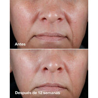 Clinique Smart Clinical Repair Rich Cream  50ml-207450 Clinique Smart Clinical Repair Rich Cream  50ml-207450 2